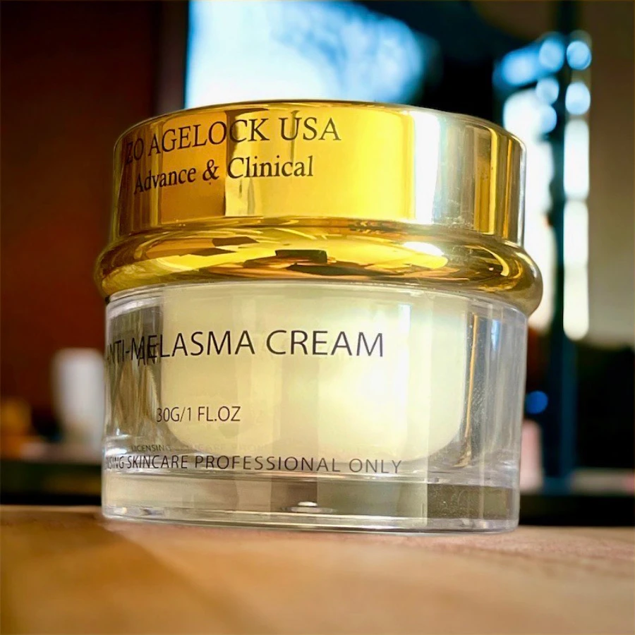 Melasma cream